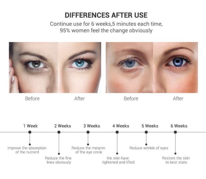 Water Glow Eye Wrinkle Remover - Image 5